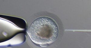 ICSI: Assessing the pros and cons of what we now know!