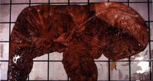 What can cause a mare to lose her pregnancy?