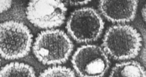 EHV1-outbreak in Valencia/Spain – and it is spread