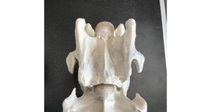 New inheritable trend: Equine complex vertebral malformation