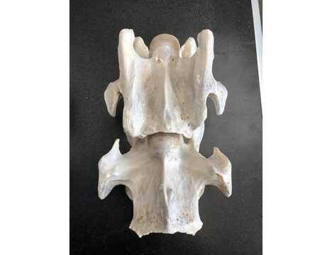 New inheritable trend: Equine complex vertebral malformation - Breeding ...