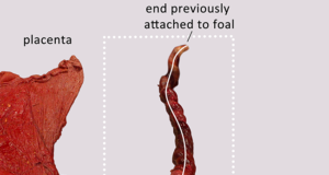 Madison Ricard: Unravelling the umbilical cord, literally!