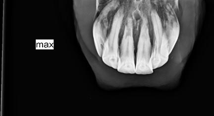 When your horse’s smile hurts: The silent pain of EOTRH