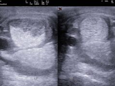 Equine tendinopathies: The new generation of treatments
